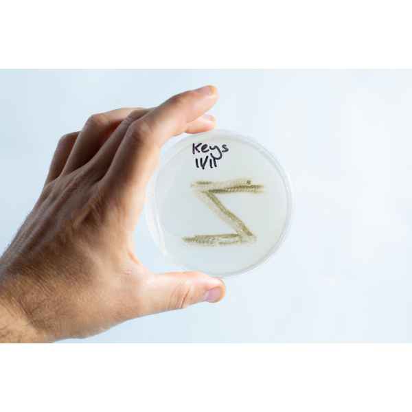 A hand holds an agar Petri dish MEA from the School Science Fun Project Kit, labelled “Keys 11/11,” displaying a fuzzy pattern—great for classroom experiments.
